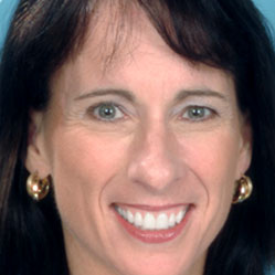 See how Modern Restorative Dentistry works wonders in Diane's review!